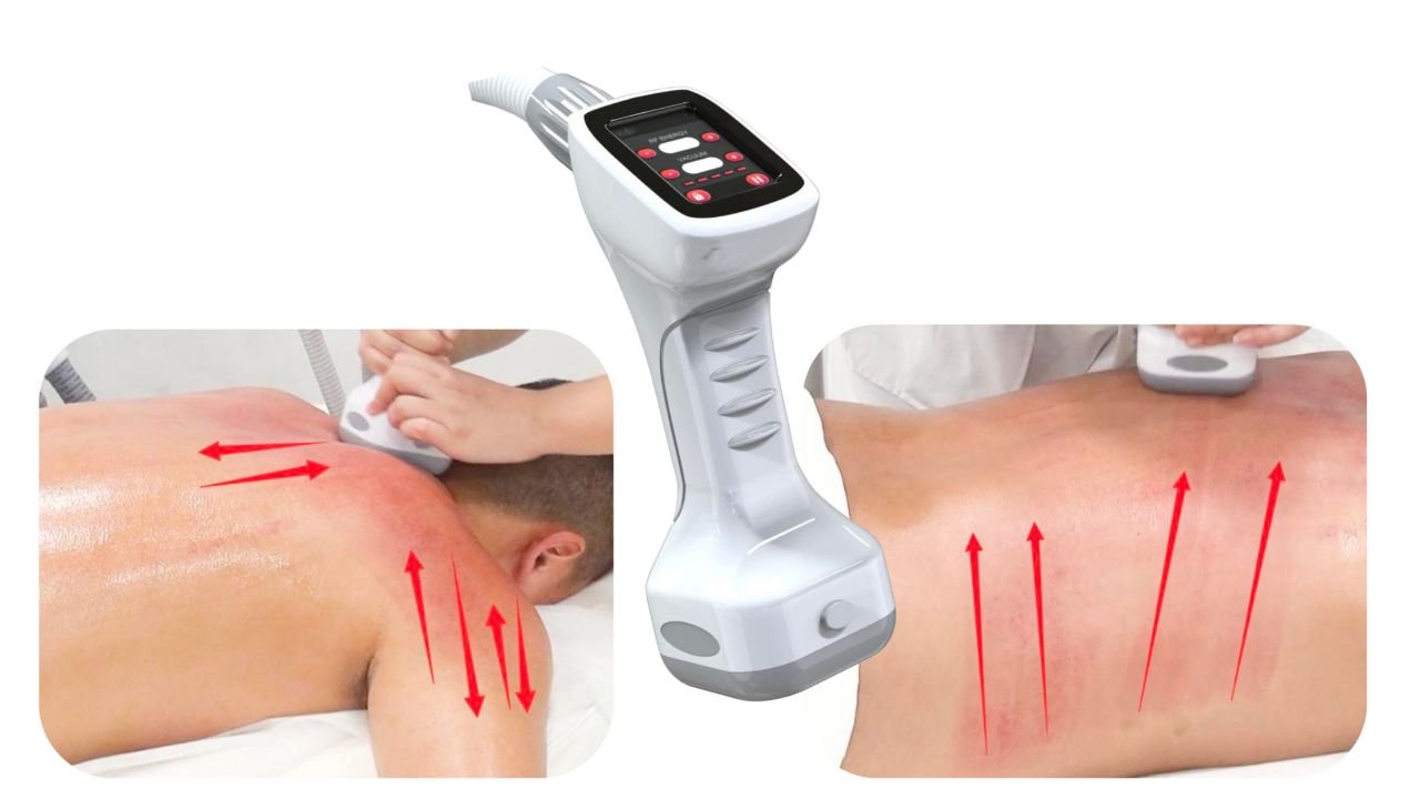 Treatment VShape